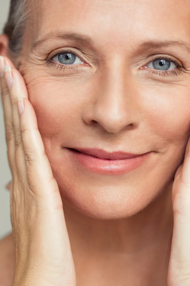 Woman with smooth, even-toned skin after chemical skin peel treatment