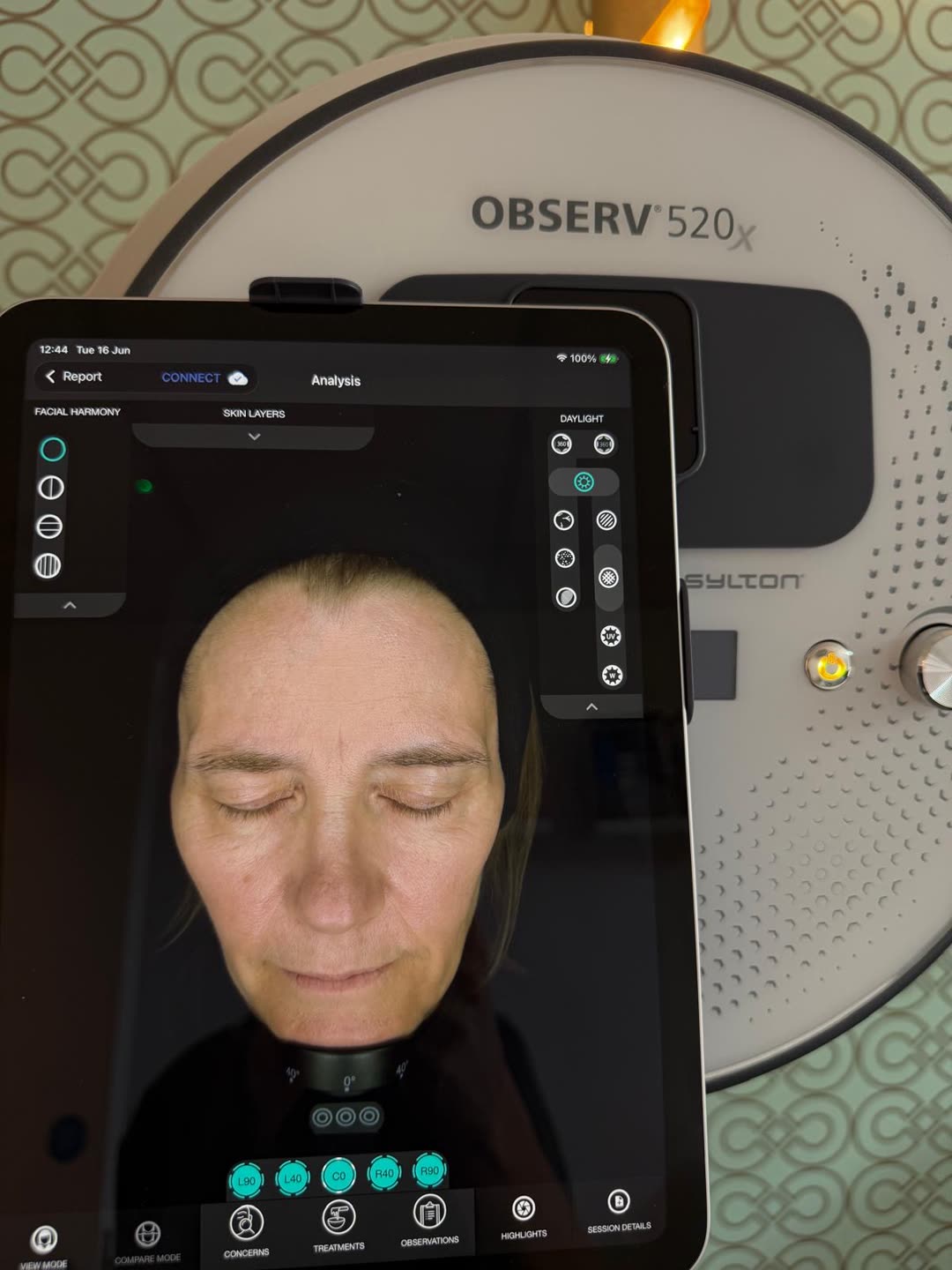Close-up of the OBSERV 520x skin scanner and analysis screen at Forever Facial Aesthetics