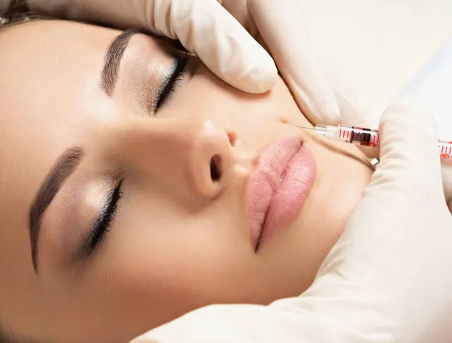 Chemical Skin Peels